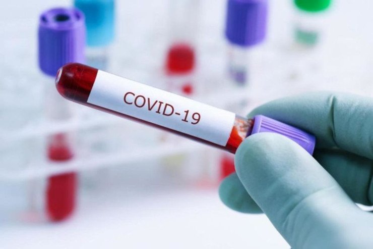 Şimali Koreyada koronavirusdan ölənlər artdı