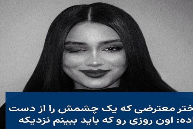 Molla rejimi gənc qızın gözünü çıxardı Molla rejimi gənc qızın gözünü çıxardı